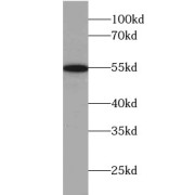 WB analysis of HepG2 cells, using UGP2 antibody (1/500 dilution).