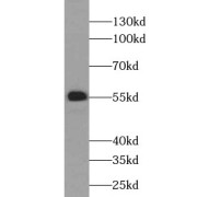 WB analysis of human liver tissue, using UGT2B4 antibody (1/500 dilution).