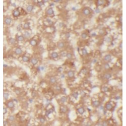 UDP Glucuronosyltransferase Family 2 Member B7 (UGT2B7) Antibody