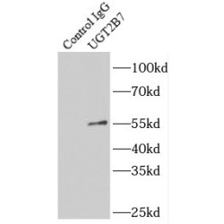 UDP Glucuronosyltransferase Family 2 Member B7 (UGT2B7) Antibody