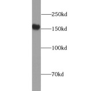 WB analysis of rat skeletal muscle tissue, using ULK1 antibody (1/300 dilution).