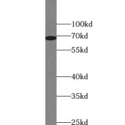 WB analysis of mouse colon tissue, using UNC5CL antibody (1/300 dilution).