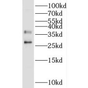 WB analysis of human testis tissue, using UNG antibody (1/1000 dilution).