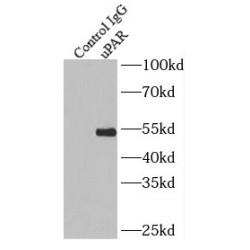 Plasminogen Activator, Urokinase Receptor (uPAR) Antibody