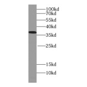 WB analysis of RAW264.7 cells, using uPAR, PLAUR antibody (1/500 dilution).