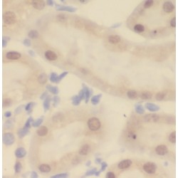 Regulator of Nonsense Transcripts 1 (UPF1) Antibody