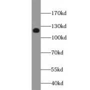 WB analysis of HepG2 cells, using UPF1 antibody (1/1000 dilution).