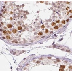 Regulator of Nonsense Transcripts 3A (UPF3A) Antibody