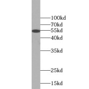 WB analysis of human testis tissue, using UPF3A antibody (1/500 dilution).