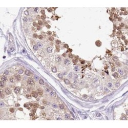 Regulator of Nonsense Transcripts 3B (UPF3B) Antibody