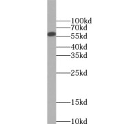 WB analysis of Jurkat cells, using UPF3B antibody (1/2000 dilution).