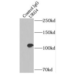 HBV X Protein Up-Regulated Gene 4 Protein (URG4) Antibody