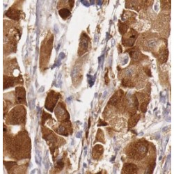 Ubiquitin-Related Modifier 1 (URM1) Antibody