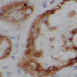 Uroguanylin Antibody