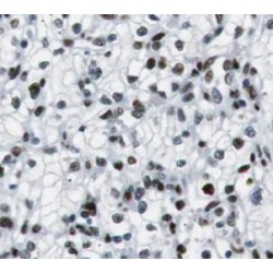 Upstream Stimulatory Factor 1 (USF1) Antibody