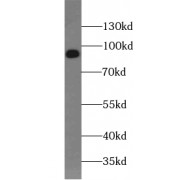 WB analysis of A549 cells, using USHBP1 antibody (1/300 dilution).