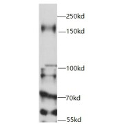 WB analysis of HeLa cells, using USP19 antibody (1/1000 dilution).