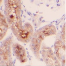 Ubiquitin Carboxyl-Terminal Hydrolase 20 (USP20) Antibody