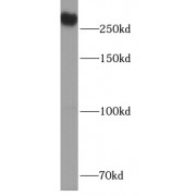 WB analysis of mouse lung tissue, using USP24 antibody (1/300 dilution).