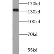 WB analysis of BxPC-3 cells, using USP25 antibody (1/1000 dilution).