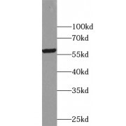 WB analysis of K-562 cells, using USP3 antibody (1/500 dilution).