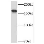 WB analysis of HeLa cells, using USP32 antibody (1/400 dilution).