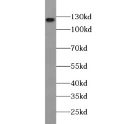 WB analysis of Jurkat cells, using USP36 antibody (1/200 dilution).