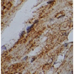 Ubiquitin Carboxyl-Terminal Hydrolase 38 (USP38) Antibody