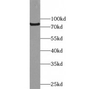 WB analysis of human placenta tissue, using USP44 antibody (1/500 dilution).