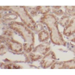 Ubiquitin Carboxyl-Terminal Hydrolase 46 (USP46) Antibody