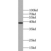 WB analysis of human kidney tissue, using USP46 antibody (1/500 dilution).