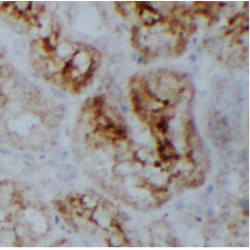 Ubiquitin Carboxyl-Terminal Hydrolase 49 (USP49) Antibody