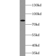 WB analysis of MCF7 cells, using USP49 antibody (1/1000 dilution).