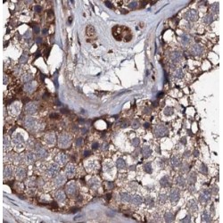 Inactive Ubiquitin Carboxyl-Terminal Hydrolase 50 (USP50) Antibody