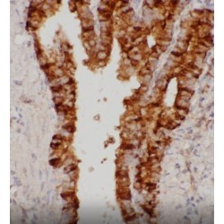 Uteroglobin (SCGB1A1) Antibody