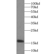 WB analysis of mouse brain tissue, using VAMP2 antibody (1/600 dilution).