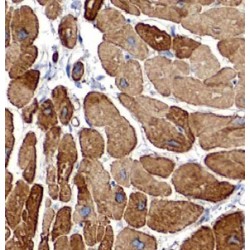 Vesicle-Associated Membrane Protein 3 (VAMP3) Antibody