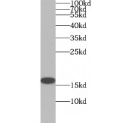 WB analysis of HL-60 cells, using VAMP8 antibody (1/300 dilution).