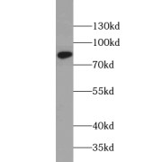 WB analysis of human heart tissue, using AOC3 antibody (1/400 dilution).