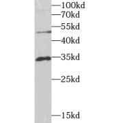 WB analysis of HeLa cells, using VAPB antibody (1/1000 dilution).