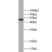 WB analysis of Jurkat cells, using VAT1 antibody (1/2000 dilution).