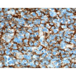 Vascular Cell Adhesion Molecule 1 (VCAM1) Antibody