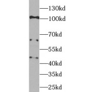 WB analysis of HeLa cells, using VCAM-1 antibody (1/1000 dilution).