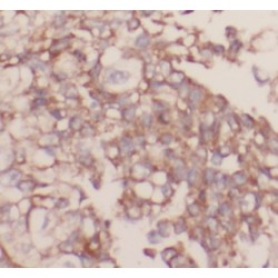 Vascular Endothelial Growth Factor Receptor 1 / VEGFR1 (FLT1) Antibody
