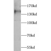 WB analysis of HEK-293 cells, using VEGFR1, FLT1 antibody (1/1000 dilution).