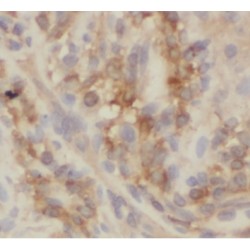 Villin (VIL) Antibody