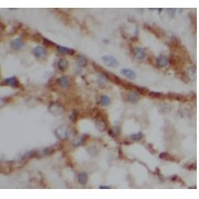 IHC-P analysis of human kidney tissue, using VIPR1 Antibody (1/50 dilution).