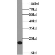 WB analysis of HeLa cells, using VMO1 antibody (1/300 dilution).