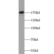 WB analysis of HeLa cells, using VPRBP antibody (1/500 dilution).