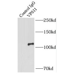 Vacuolar Protein Sorting-Associated Protein 11 Homolog (VPS11) Antibody